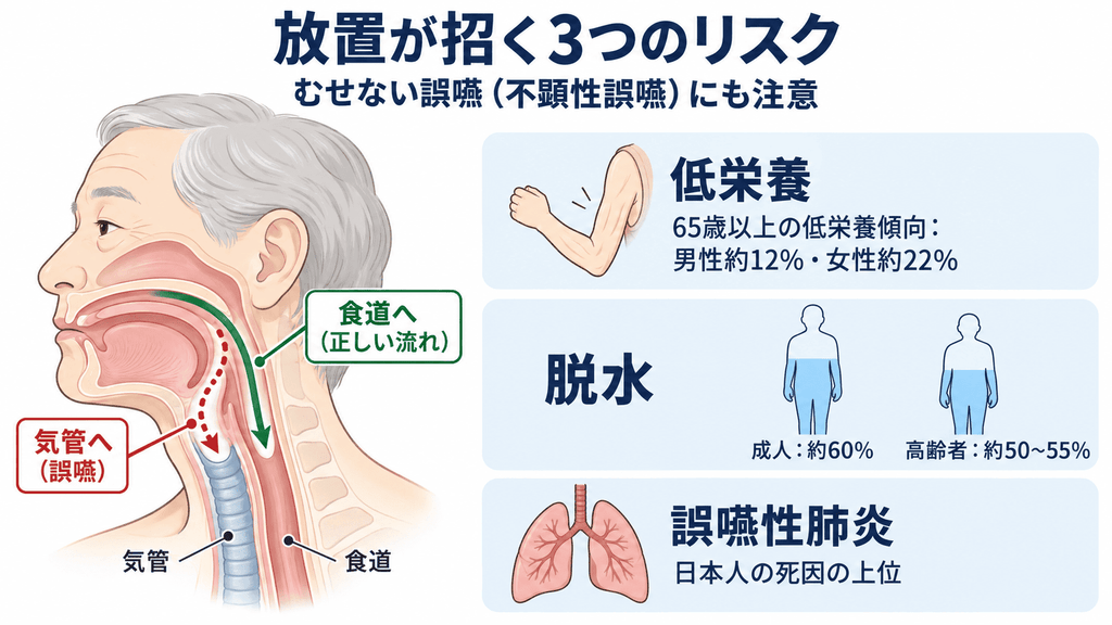 食べ物が食道ではなく気管に入る誤嚥の仕組みと、低栄養・脱水・誤嚥性肺炎の3つのリスクを示す図解